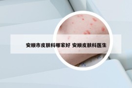 安顺市皮肤科哪家好 安顺皮肤科医生