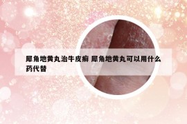犀角地黄丸治牛皮癣 犀角地黄丸可以用什么药代替