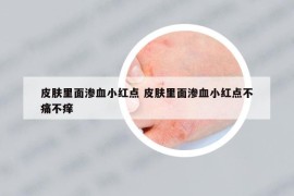 皮肤里面渗血小红点 皮肤里面渗血小红点不痛不痒