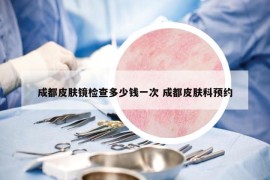 成都皮肤镜检查多少钱一次 成都皮肤科预约