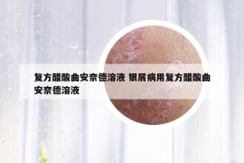 复方醋酸曲安奈德溶液 银屑病用复方醋酸曲安奈德溶液