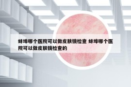 蚌埠哪个医院可以做皮肤镜检查 蚌埠哪个医院可以做皮肤镜检查的