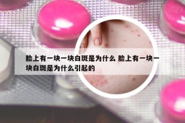 脸上有一块一块白斑是为什么 脸上有一块一块白斑是为什么引起的