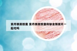紫丹银屑胶囊 紫丹银屑胶囊和郁金银屑片一起吃吗
