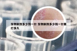 生物制剂多少钱一针 生物制剂多少钱一针要打多久