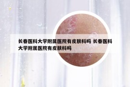 长春医科大学附属医院有皮肤科吗 长春医科大学附属医院有皮肤科吗