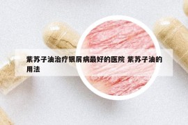 紫苏子油治疗银屑病最好的医院 紫苏子油的用法