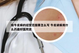 除牛皮癣的经营范围要怎么写 牛皮顽癣用什么药最好医院卖