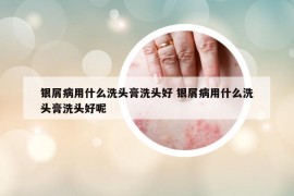银屑病用什么洗头膏洗头好 银屑病用什么洗头膏洗头好呢
