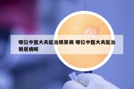 哪位中医大夫能治银屑病 哪位中医大夫能治银屑病呢