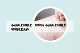 小孩身上和脸上一块块藓 小孩身上和脸上一块块藓怎么办