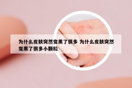 为什么皮肤突然变黑了很多 为什么皮肤突然变黑了很多小颗粒