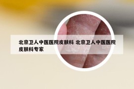 北京卫人中医医院皮肤科 北京卫人中医医院皮肤科专家