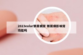 2023eular银屑病肾 银屑病影响肾功能吗