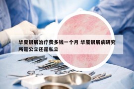 华夏银屑治疗费多钱一个月 华厦银屑病研究所是公立还是私立
