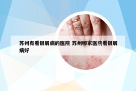 苏州有看银屑病的医院 苏州哪家医院看银屑病好