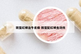 斑蝥红娘治牛皮癣 斑蝥配红娘虫功效