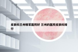 皮肤科兰州哪家医院好 兰州的医院皮肤科排行