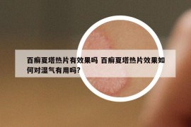 百癣夏塔热片有效果吗 百癣夏塔热片效果如何对湿气有用吗?