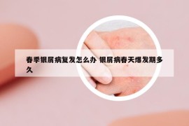 春季银屑病复发怎么办 银屑病春天爆发期多久