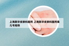 上海新华皮肤科医院 上海新华皮肤科医院乘几号地铁