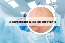 点滴状银屑病扁条体 点滴状银屑病变成片状