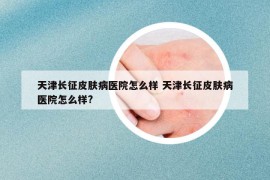 天津长征皮肤病医院怎么样 天津长征皮肤病医院怎么样?