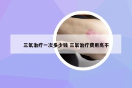 三氧治疗一次多少钱 三氧治疗费用高不