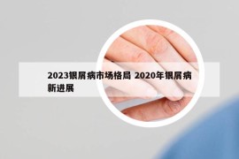 2023银屑病市场格局 2020年银屑病新进展