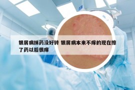 银屑病抹药没好转 银屑病本来不痒的现在擦了药以后很痒
