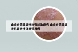 曲安奈德益康唑软膏能治癣吗 曲安奈德益康唑乳膏治疗体癣管用吗