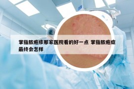 掌指脓疱疹那家医院看的好一点 掌指脓疱症最终会怎样