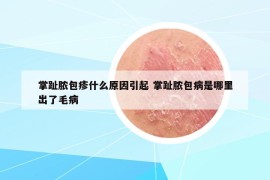 掌趾脓包疹什么原因引起 掌趾脓包病是哪里出了毛病