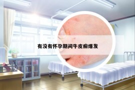 有没有怀孕期间牛皮癣爆发