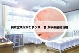 初肤堂紫椒癣酊多少钱一套 紫椒癣酊的价格