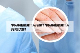 掌跖脓疱病用什么药最好 掌跖脓疱病用什么药膏比较好