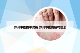 郑州市医院牛皮癣 郑州市医院招聘信息