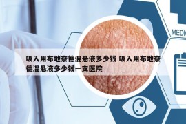 吸入用布地奈德混悬液多少钱 吸入用布地奈德混悬液多少钱一支医院