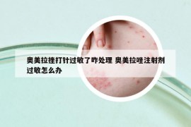 奥美拉挫打针过敏了咋处理 奥美拉唑注射剂过敏怎么办