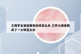 三周岁女宝皮肤有白块怎么办 三岁小孩皮肤白了一小块怎么办