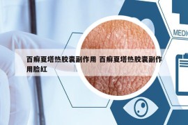 百癣夏塔热胶囊副作用 百癣夏塔热胶囊副作用脸红