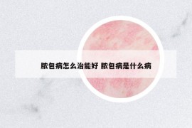 脓包病怎么治能好 脓包病是什么病