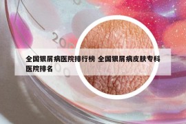 全国银屑病医院排行榜 全国银屑病皮肤专科医院排名