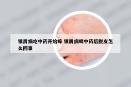 银屑病吃中药开始痒 银屑病喝中药后脱皮怎么回事