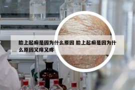 脸上起癣是因为什么原因 脸上起癣是因为什么原因又痒又疼