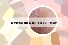 华佗止痒膏治什么 华佗止痒膏治什么病的