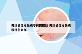 天津长征皮肤病专科医医院 天津长征皮肤病医院怎么样