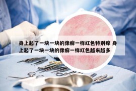 身上起了一块一块的像癣一样红色特别痒 身上起了一块一块的像癣一样红色越来越多