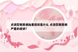点滴型银屑病加重症状是什么 点滴型银屑病严重的症状?