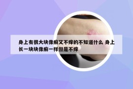 身上有很大块像癣又不痒的不知道什么 身上长一块块像癣一样但是不痒